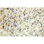 ERCC2 Rabbit Polyclonal Antibody (10818-1-AP)