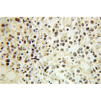 ERCC2 Rabbit Polyclonal Antibody (10818-1-AP)