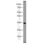 PGF Rabbit Polyclonal Antibody (10642-1-AP)