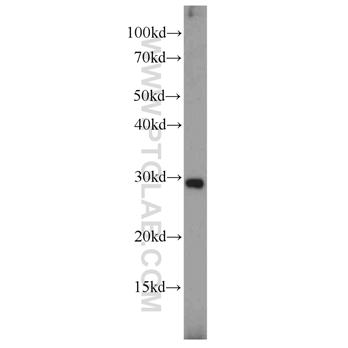 PGF Rabbit Polyclonal Antibody (10642-1-AP)