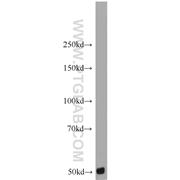 CARD9 Rabbit Polyclonal Antibody (10669-1-AP)