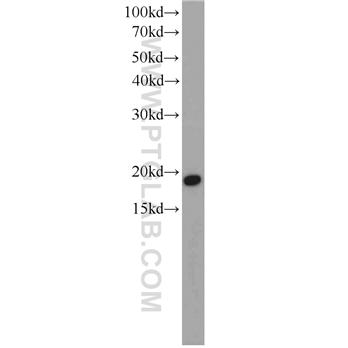 CGGBP1 Rabbit Polyclonal Antibody (10716-1-AP)