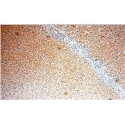 LTF Rabbit Polyclonal Antibody (10933-1-AP)