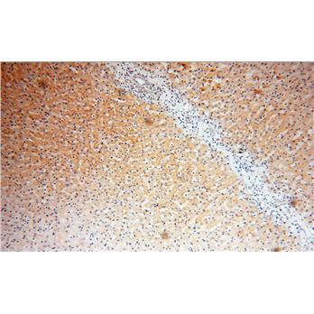 LTF Rabbit Polyclonal Antibody (10933-1-AP)