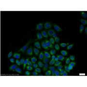 HSP90B1 Rabbit Polyclonal Antibody (10979-1-AP)