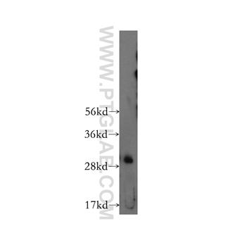 CTDSP2 Rabbit Polyclonal Antibody (11116-1-AP)