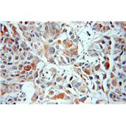 MIPEP Rabbit Polyclonal Antibody (11002-1-AP)
