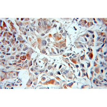 MIPEP Rabbit Polyclonal Antibody (11002-1-AP)