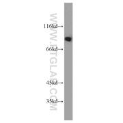 TRIP10 Rabbit Polyclonal Antibody (10798-1-AP)
