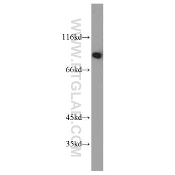 TRIP10 Rabbit Polyclonal Antibody (10798-1-AP)