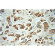 FH Rabbit Polyclonal Antibody (10966-1-AP)