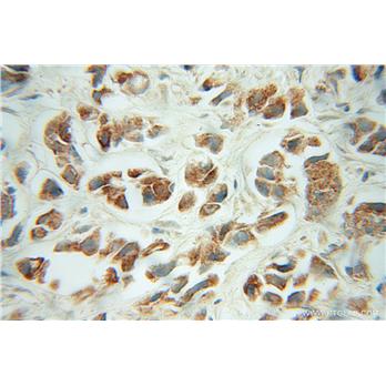 FH Rabbit Polyclonal Antibody (10966-1-AP)
