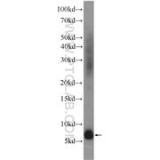 ADM Rabbit Polyclonal Antibody (10778-1-AP)