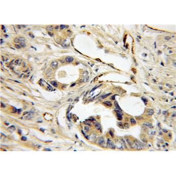LDB3 Rabbit Polyclonal Antibody (11004-1-AP)