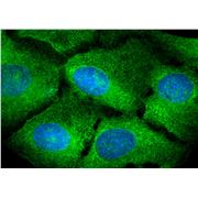 PELO Rabbit Polyclonal Antibody (10582-1-AP)