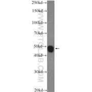 NPTX2 Rabbit Polyclonal Antibody (10889-1-AP)