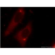 DDX3X Rabbit Polyclonal Antibody (11115-1-AP)