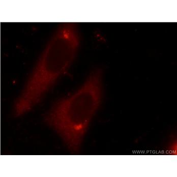 DDX3X Rabbit Polyclonal Antibody (11115-1-AP)