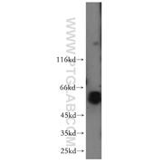 PRPF4 Rabbit Polyclonal Antibody (10728-1-AP)