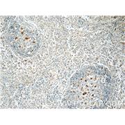 WAS Rabbit Polyclonal Antibody (10987-1-AP)