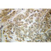 VPS18 Rabbit Polyclonal Antibody (10901-1-AP)