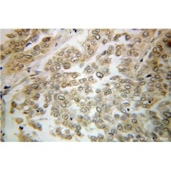VPS18 Rabbit Polyclonal Antibody (10901-1-AP)