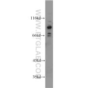 FOXO3 Rabbit Polyclonal Antibody (10849-1-AP)