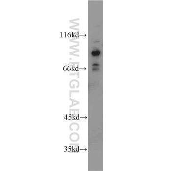 FOXO3 Rabbit Polyclonal Antibody (10849-1-AP)