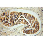 KRT33B Rabbit Polyclonal Antibody (11048-1-AP)