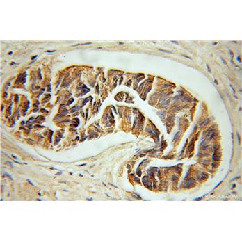 KRT33B Rabbit Polyclonal Antibody (11048-1-AP)