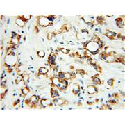 FCER1A Rabbit Polyclonal Antibody (10980-1-AP)