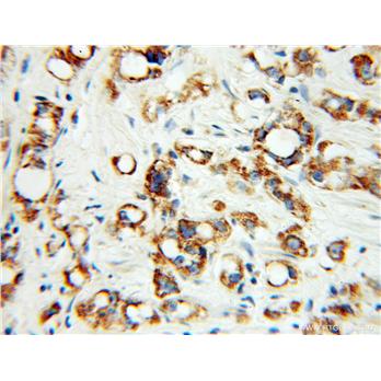 FCER1A Rabbit Polyclonal Antibody (10980-1-AP)