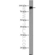 ITGB2 Rabbit Polyclonal Antibody (10554-1-AP)