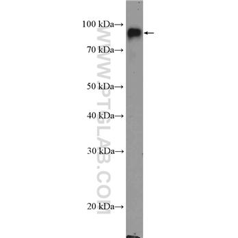 ITGB2 Rabbit Polyclonal Antibody (10554-1-AP)