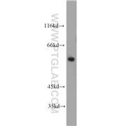 FBXO5 Rabbit Polyclonal Antibody (10872-1-AP)