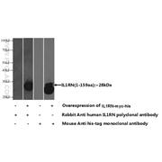IL1RN Rabbit Polyclonal Antibody (10844-1-AP)