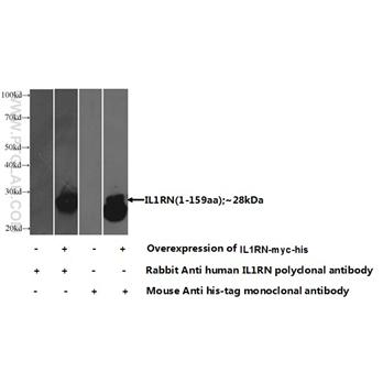 IL1RN Rabbit Polyclonal Antibody (10844-1-AP)