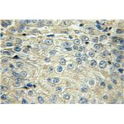 SLCO6A1 Rabbit Polyclonal Antibody (11078-1-AP)