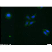 PRDX3 Rabbit Polyclonal Antibody (10664-1-AP)