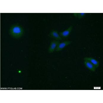 PRDX3 Rabbit Polyclonal Antibody (10664-1-AP)