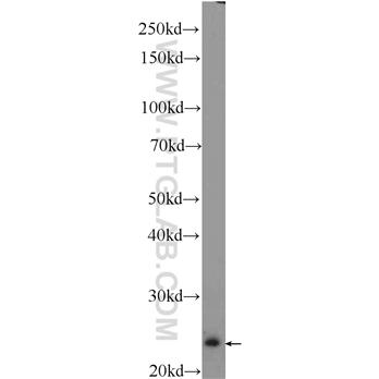 PEBP1 Rabbit Polyclonal Antibody (10575-1-AP)