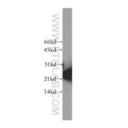 SKP1 Rabbit Polyclonal Antibody (10990-2-AP)