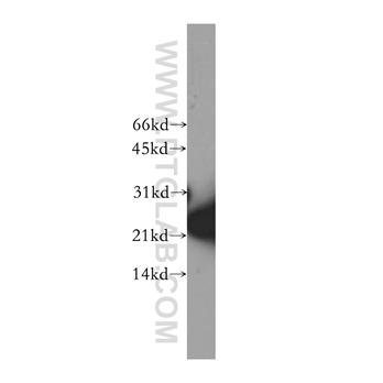 SKP1 Rabbit Polyclonal Antibody (10990-2-AP)