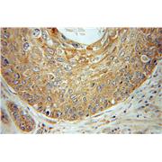 SCYE1 Rabbit Polyclonal Antibody (11091-1-AP)