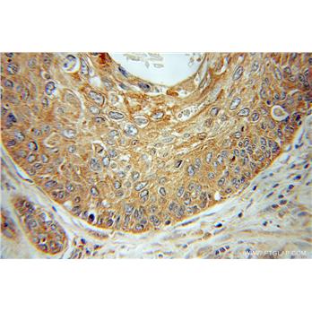 SCYE1 Rabbit Polyclonal Antibody (11091-1-AP)