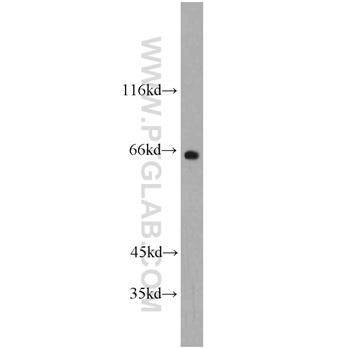 FMR1NB Rabbit Polyclonal Antibody (11069-2-AP)