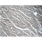 VAMP3 Rabbit Polyclonal Antibody (10702-1-AP)