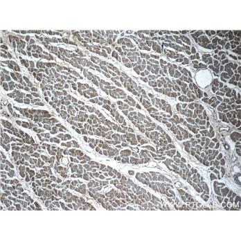 VAMP3 Rabbit Polyclonal Antibody (10702-1-AP)