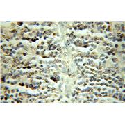 TFDP1 Rabbit Polyclonal Antibody (11043-1-AP)