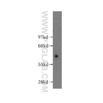 ATP1B3 Rabbit Polyclonal Antibody (11142-1-AP)